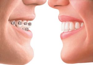 tratamientos dentales: ortodoncias